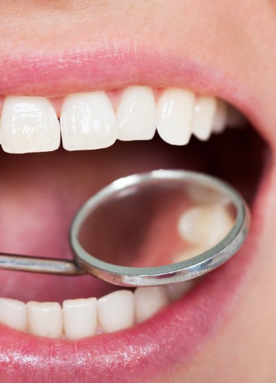 Dentist examining patient's smile after metal free dental crown