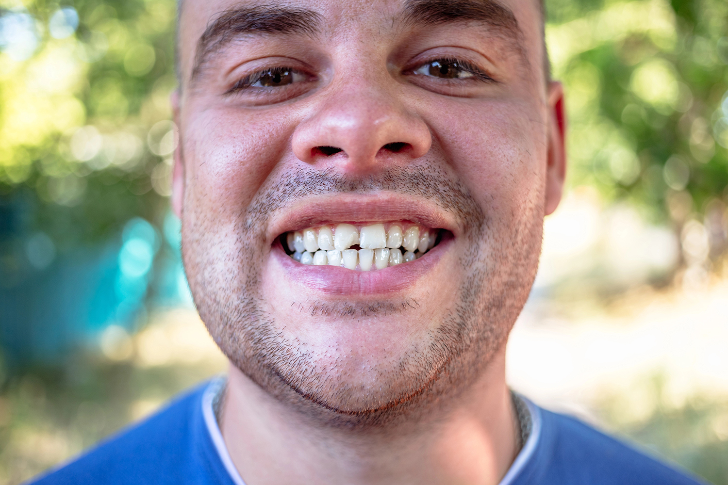 Young man in a blue T-shirt with a chipped tooth.
